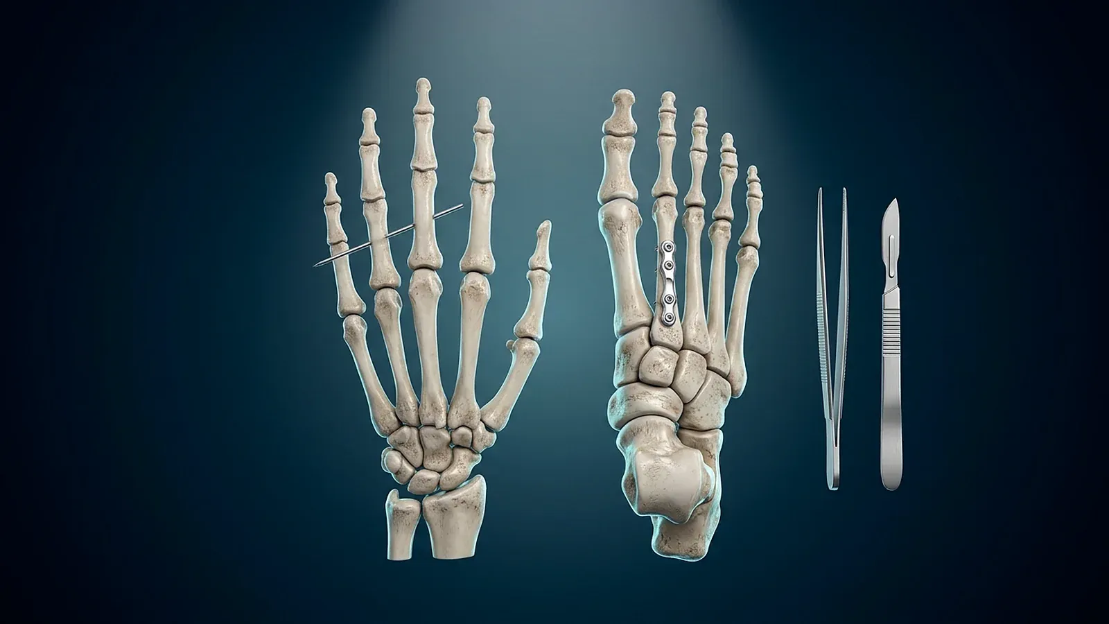 Kodierung in der Hand- und Fußchirurgie