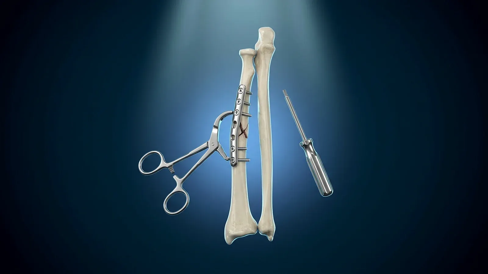 Kodierung in der Unfallchirurgie