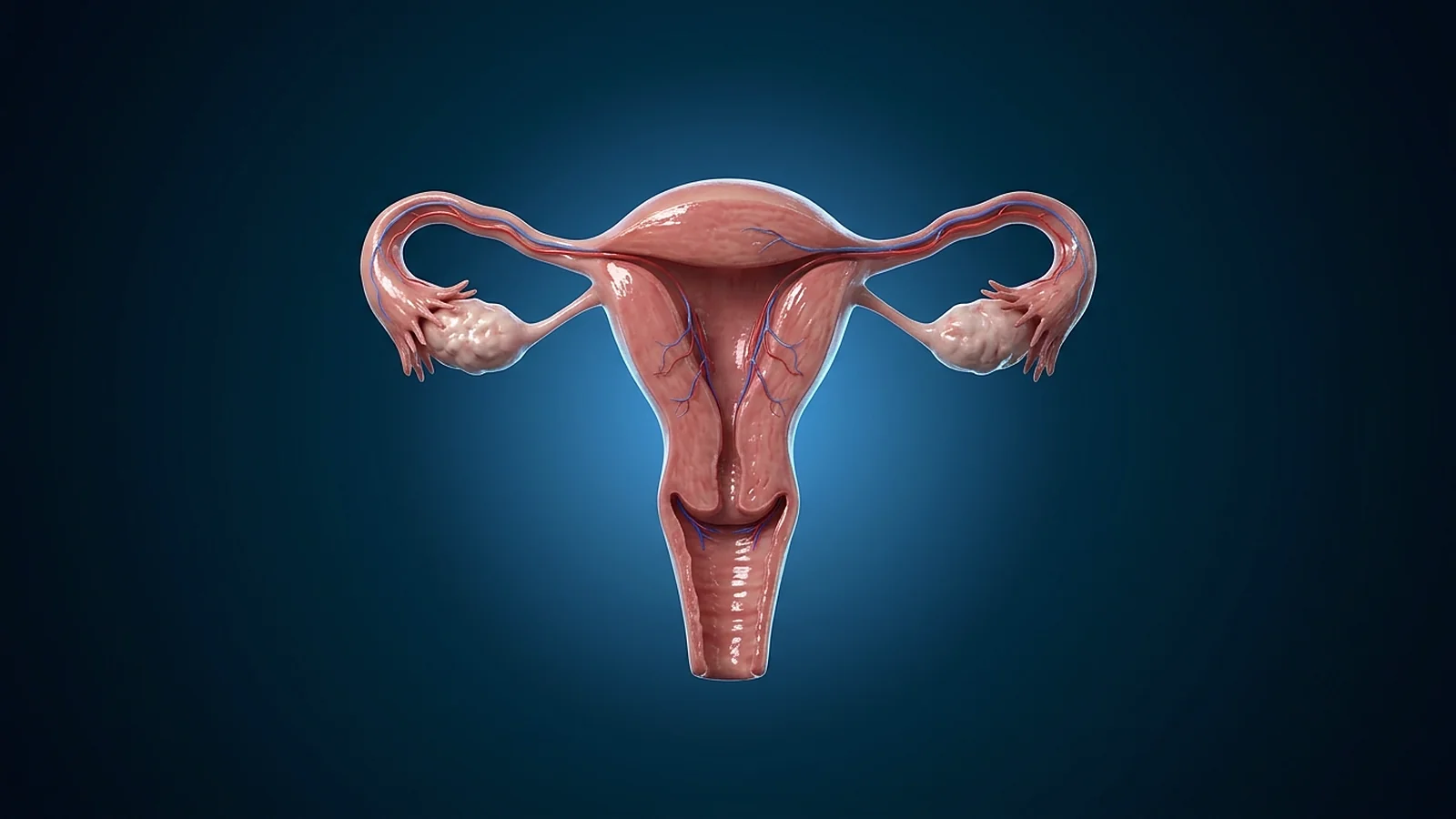 3D-Darstellung der Gebärmutter mit Eileitern und Eierstöcken