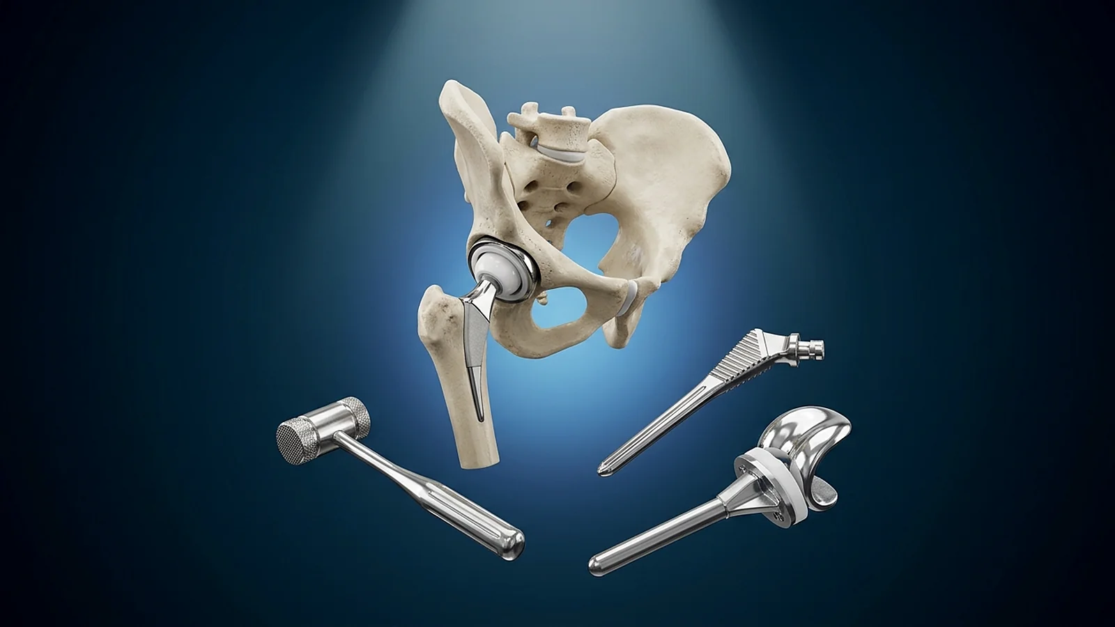 3D-Darstellung einer Hüftendoprothese mit Knieprothese, Raspel und OP-Hammer